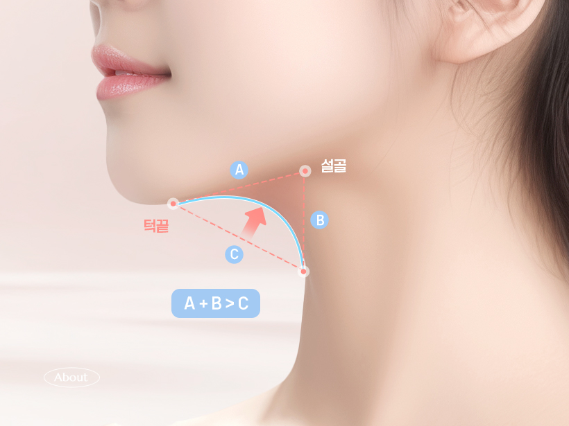 이중턱 근육묶기란?